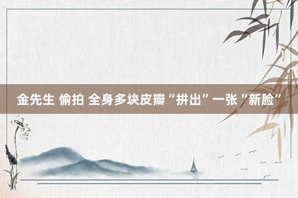 金先生 偷拍 全身多块皮瓣“拼出”一张“新脸”